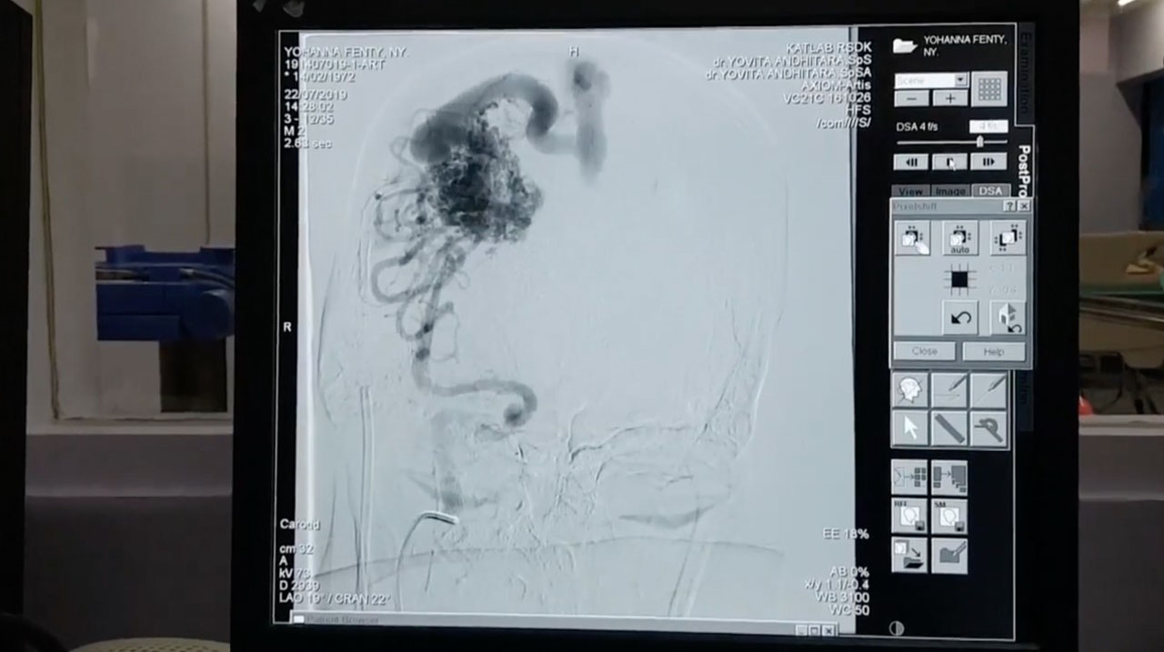 Catheterization Laboratory NEURO 2